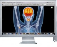 Osirix Workstation